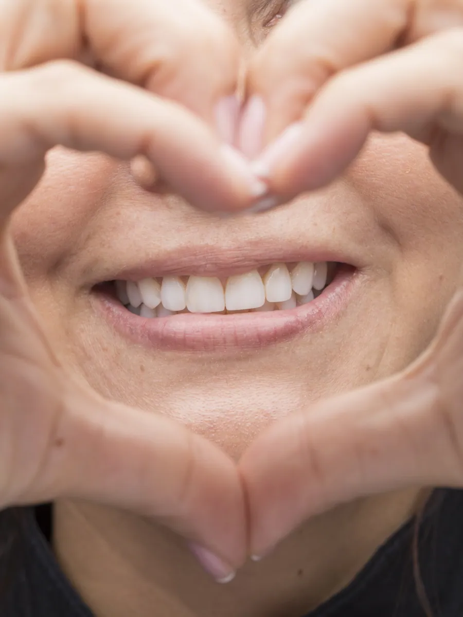 Natural smile of a Smiles by Julia Molina patient in Colombia